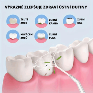 DentStream_2