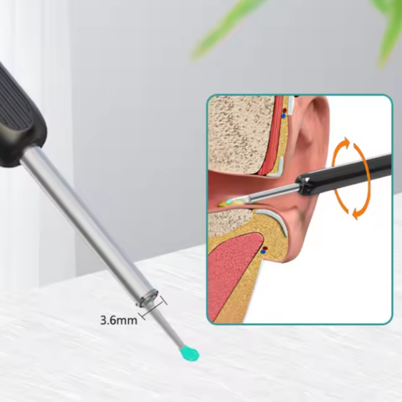 Chytrý čistič uší s HD kamerou + příslušenství - Obrázek 6