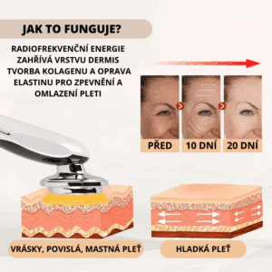 FACE-LIFTING-4